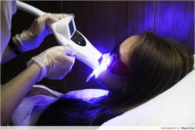 blanqueamiento dental led laser